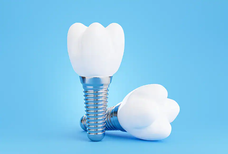 dental implants at OC Perio