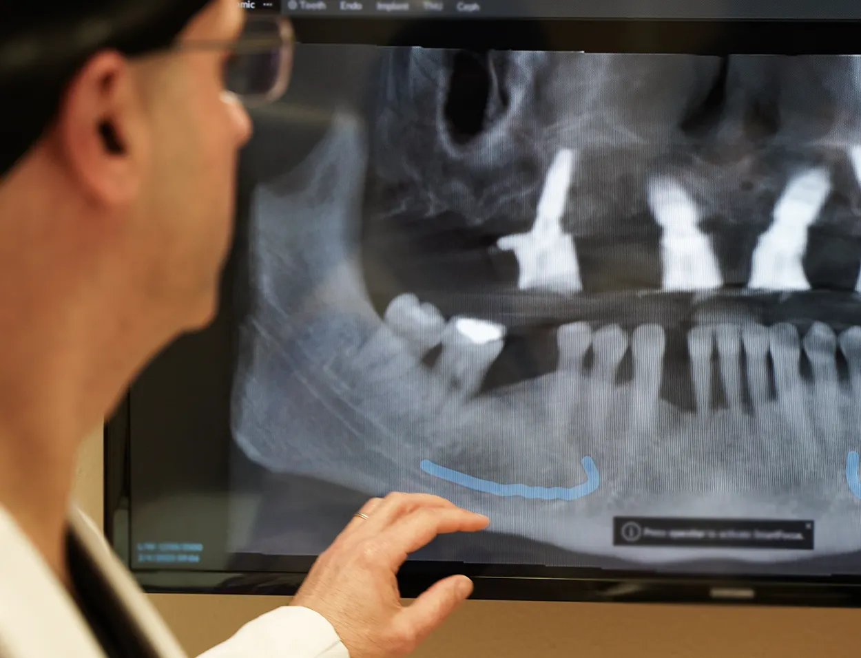 Dr. Reshad reviewing a dental implant X-ray on screen at OC Perio & Implants Dental Group