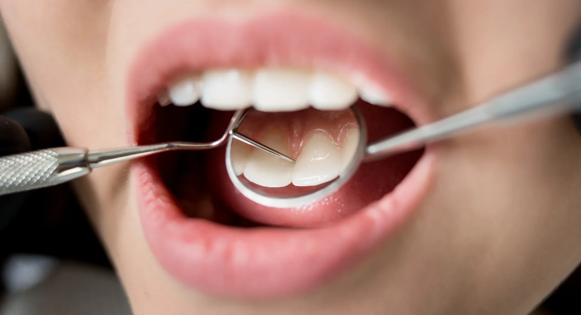 gum disease exam