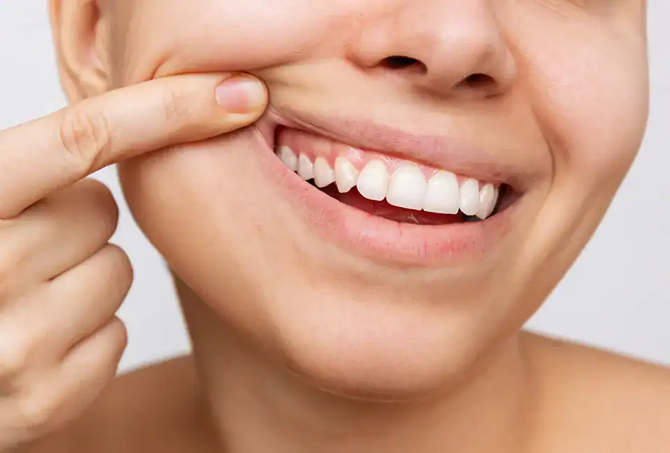 woman pointing at healthy gums after gum disease treatment