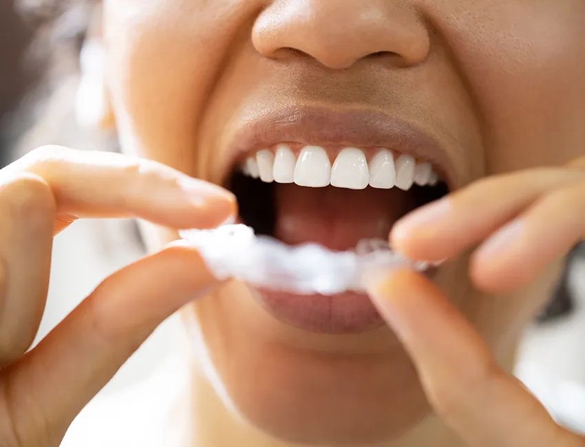 What is TMJ / TMD & Bruxism Treatment